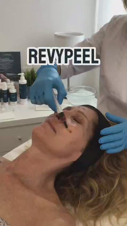 Revypeel High TCA20%